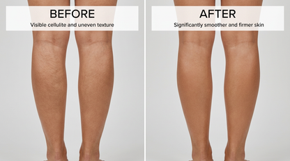 Anti Cellulite Massage Oil